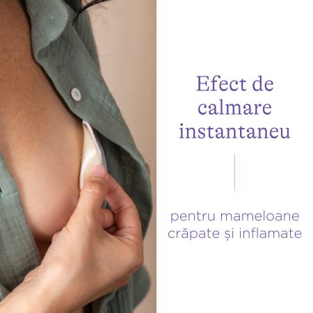 Compresa pentru calmare si protejare mameloane crapate Soothies, 2 bucati, Lansinoh 616419