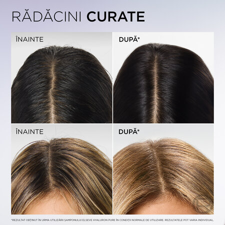 Balsam rehidratant pentru scalp si radacini grase Hyaluron Pure, 200ml, Elseve 757293