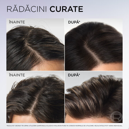 Balsam rehidratant pentru scalp si radacini grase Hyaluron Pure, 200ml, Elseve 757294