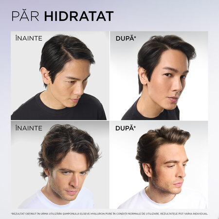 Sampon purificator pentru scalp si radacini grase Hyaluron Pure, 250ml, Elseve 757301