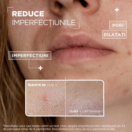 Serum anti imperfectiuni pentru tenul sensibil, 30 ml, Mixa 630189