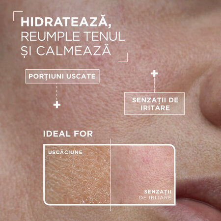 Serum anti uscaciune pentru tenul sensibil, 30 ml, Mixa 630233
