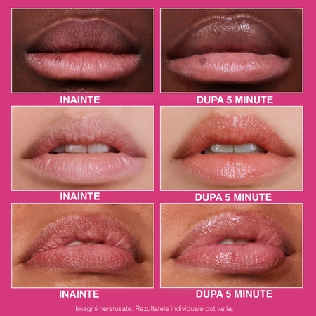 Tratament pentru buze FirmX Lip Filler, 10 ml, Peter Thomas Roth 640218