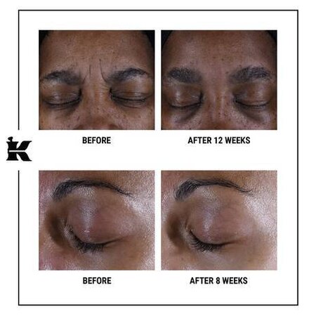 Crema multi-corectoare pentru zona ochilor Super Multi-Corrective, 28 ml, Kiehl's 642176