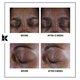 Crema multi-corectoare pentru zona ochilor Super Multi-Corrective, 28 ml, Kiehl's 642176