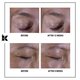 Crema multi-corectoare pentru zona ochilor Super Multi-Corrective, 14 ml, Kiehl's 642873