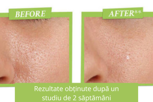 Pudra pentru curatare si minimizarea porilor, Deep Pore Minimizing and Polishing Rare Earth, 100 g, Kiehl's