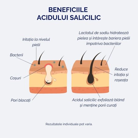 Ser cu acid salicilic 2%, pentru tenul sensibil si acneic, 30 ml, Meloni 643475