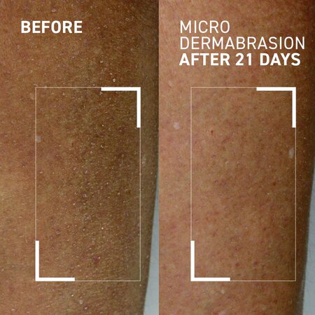 Exfoliant hidratant pentru corp Body Polishing Exfoliator Microdermabrasion, 125 ml, Dr. Brandt 647369