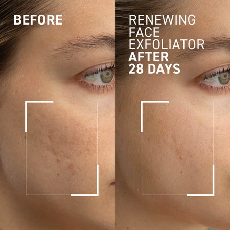 Exfoliant anti-imbatranire pentru fata Age-Defying Exfoliator Microdermabrasion, 20 ml, Dr. Brandt 647489