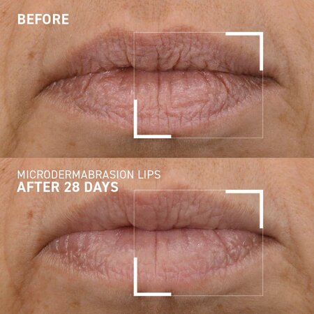 Exfoliant pentru buze Smoothing Lip Scrub Microdermabrasion, 10 ml, Dr. Brandt 647629