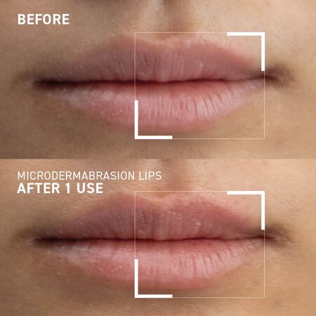 Exfoliant pentru buze Smoothing Lip Scrub Microdermabrasion, 10 ml, Dr. Brandt 647632