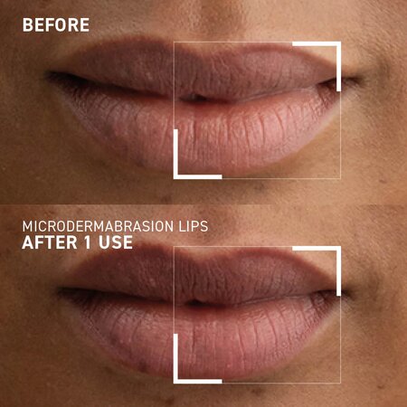 Exfoliant pentru buze Smoothing Lip Scrub Microdermabrasion, 10 ml, Dr. Brandt 647633