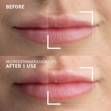 Exfoliant pentru buze Smoothing Lip Scrub Microdermabrasion, 10 ml, Dr. Brandt 647627