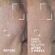 Concentrat triplu cu acizi pentru minimizarea petelor pigmentare Dark Spots No More Bright This Way, 15 ml, Dr. Brandt 647649
