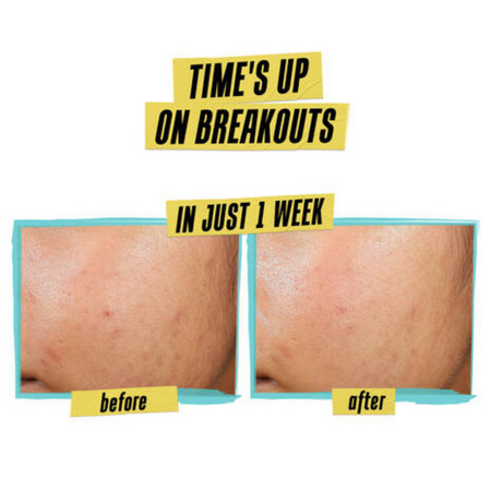 Crema anti-imperfectiuni Expertly Clear Blemish-Treating and Preventing, 60 ml, Kiehl's 660822