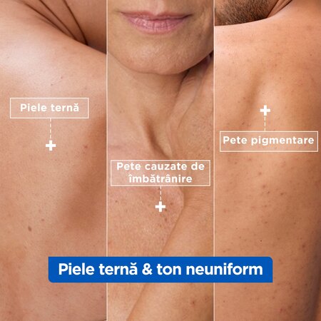 Crema hidratanta si anti-pete pigmentare pentru fata,corp si maini, Niacinamide Bright, 400 ml, Mixa 691981