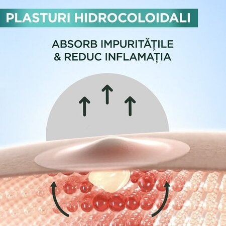 Plasturi invizibili pentru cosuri Pure Active, 22 bucati, Garnier 691993