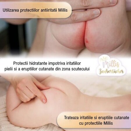 Protectii anti-iritatii pentru bebelusi Magic, 25 bucati, Millis 697371