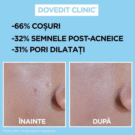 Crema fluida invizibila anti-imperfectiuni cu SPF 50+ Pure Active, 40 ml, Garnier 698907