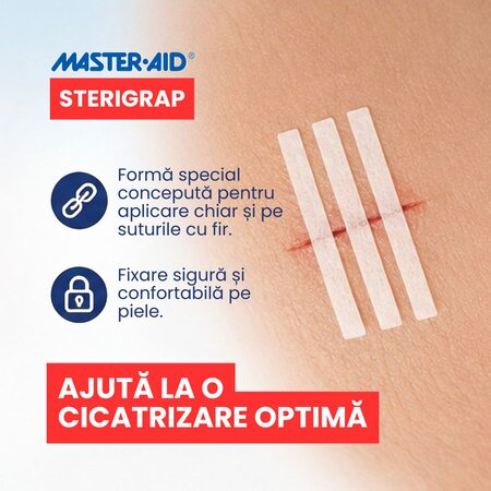 Plasture steril pentru suturare corp Sterigrap, 100x12mm, 6 bucati, Master Aid 805454