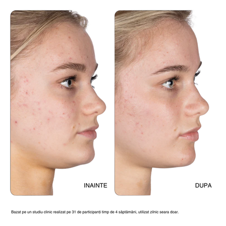 Tratament gel pentru pete 10% Retinol Fix, 15 ml, Nip+Fab 711373