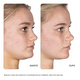 Tratament gel pentru pete 10% Retinol Fix, 15 ml, Nip+Fab 711373