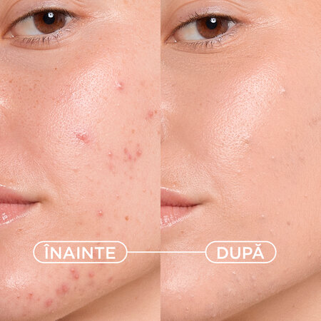 Gel crema nuantator anti-imperfectiuni Sebium Kerato+ Cover, 30 ml, Bioderma 794299