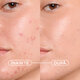 Gel crema nuantator anti-imperfectiuni Sebium Kerato+ Cover, 30 ml, Bioderma 794299