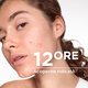 Gel crema nuantator anti-imperfectiuni Sebium Kerato+ Cover, 30 ml, Bioderma 794298