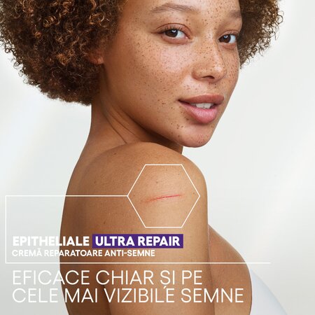 Crema reparatoare pentru pielea deteriorata Epitheliale Ultra Repair HA+, 40 ml, A-Derma 724650