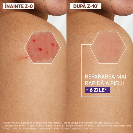 Crema reparatoare pentru pielea deteriorata Epitheliale Ultra Repair HA+, 40 ml, A-Derma 724649