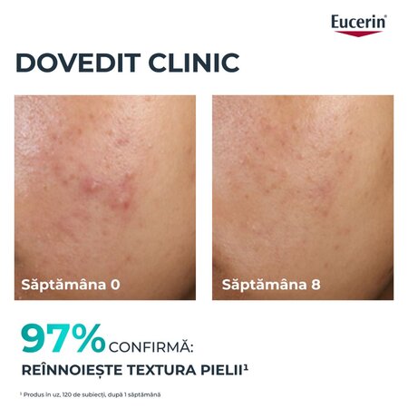 Tratament exfoliant pentru noapte Dermo Pure, 40 ml, Eucerin 724732