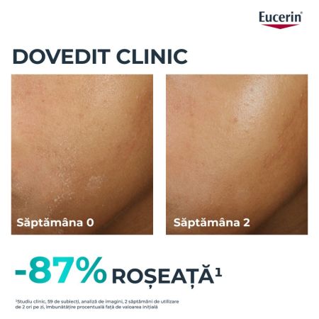 Fluid pentru fata hidratant Dermo Pure, 40 ml, Eucerin 724823