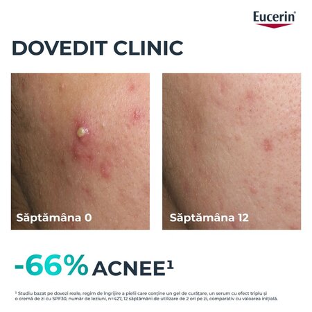 Ser cu tripla actiune Dermo Pure, 40 ml, Eucerin 728376