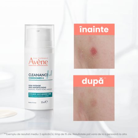 Concentrat anti-imperfectiuni pentru tenul acneic Cleanance Comedomed+, 30 ml, Avene 730649