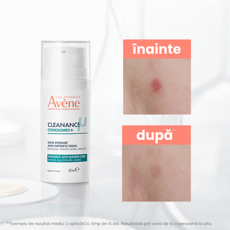Concentrat anti-imperfectiuni pentru tenul acneic Cleanance Comedomed+, 30 ml, Avene 730649