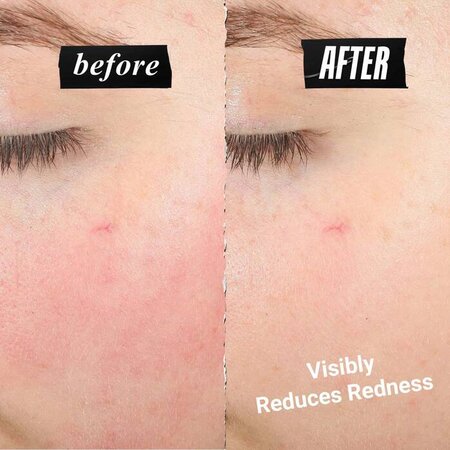 Crema hidratanta pentru reducerea disconfortului pielii Ultra Facial Meltdown Recovery, 28 ml, Kiehl's 747557