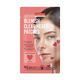 Plasturi anti-acnee cu hidrocoloid in forma de inima, 12 bucati, Purederm 766433