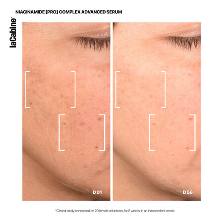 Ser de fata cu micro-sfere pentru corectarea petelor si luminozitate Niacinamide Pro Complex Multi-active, 30 ml, La Cabine 774384