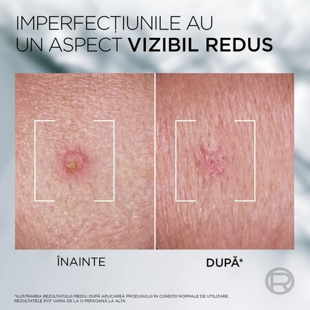 Crema pasta pentru imperfectiuni Men Expert, Derma Control SOS, 45 ml, Loreal Paris 789213