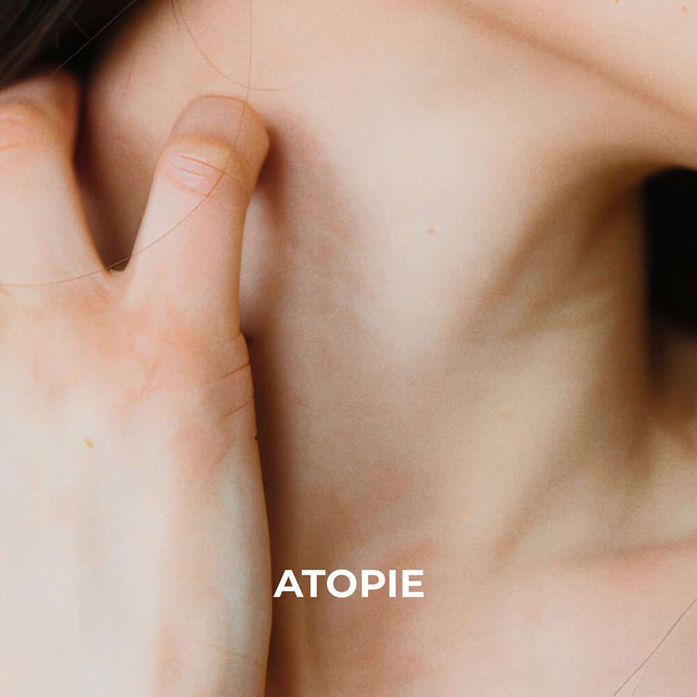 Sesderma &mdash; Atopie