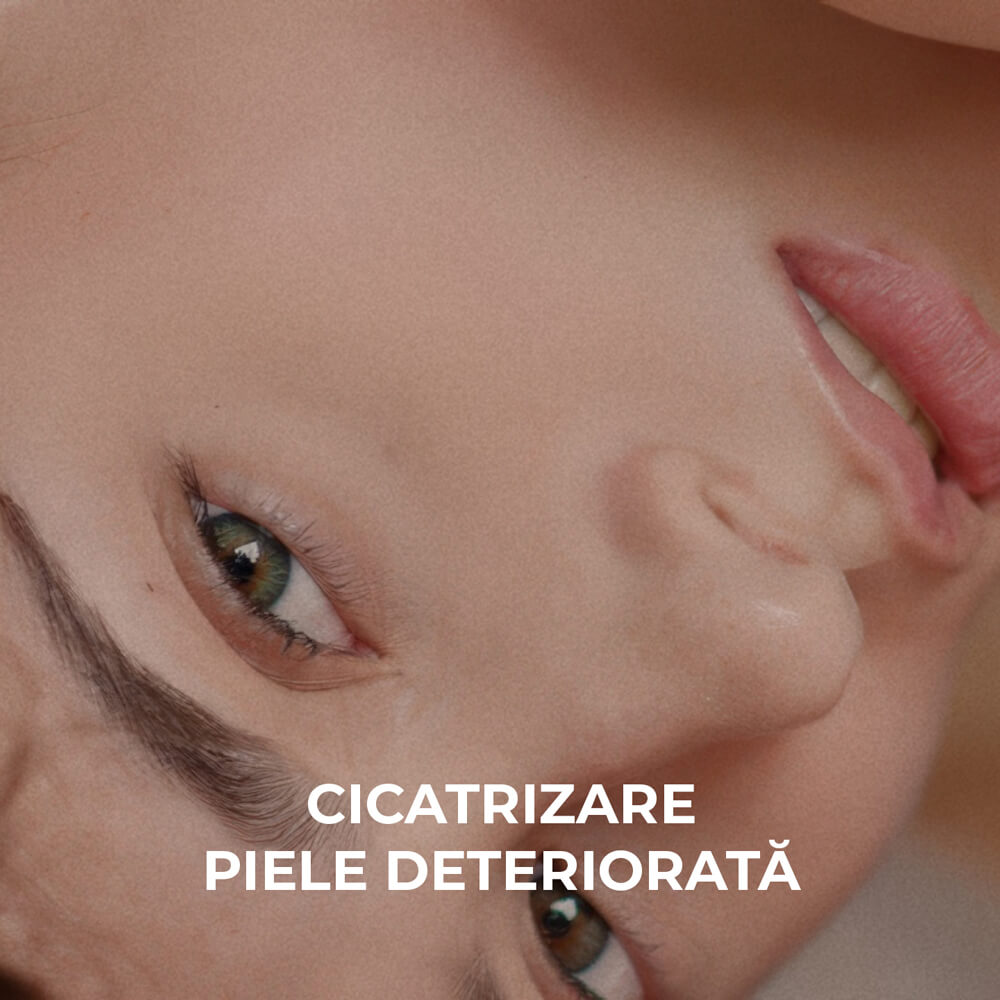 Sesderma &mdash; Cicatrizare piele deteriorata