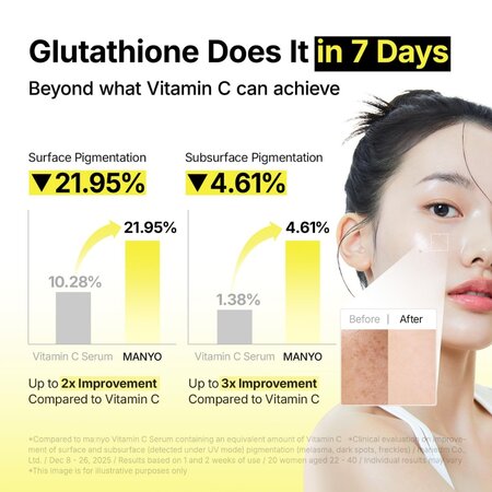 Ser pentru pete pigmentare Glutathione 7 Dark Spot, 30 ml, Manyo 799058