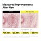 Patchuri pentru ingrijirea petelor pigmentare Glutathione 7 Dark Spot, 30 bucati, Manyo 799108