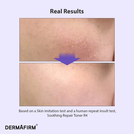 Toner calmant Soothing Repair R4, 150 ml, Dermafirm 801508