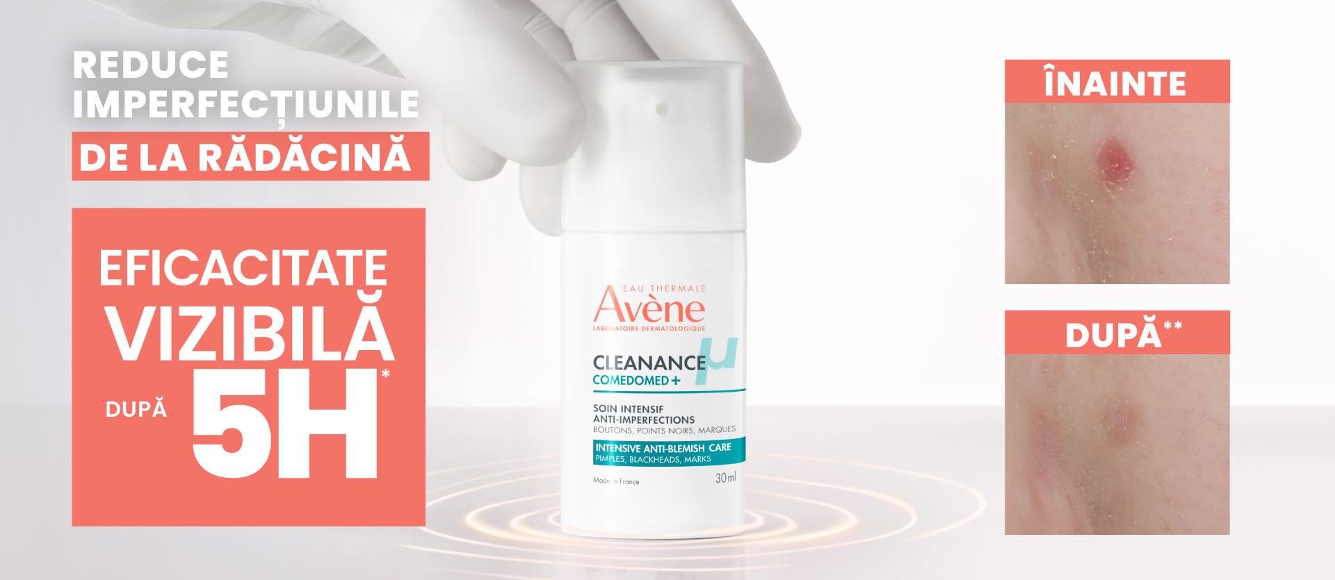 Avene Cleanance Comedomed eficacitate vizibila dupa 5 ore
