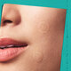 Plasturi hidrocoloidali pentru imperfectiuni Truly Targeted Overnight Blemish, 22 bucati, Kiehl's 815525