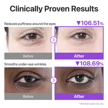 Plasturi pentru ochi No.9 NAD+ Collagen Under Eye Patches, 5 buc, Numbuzin 824007