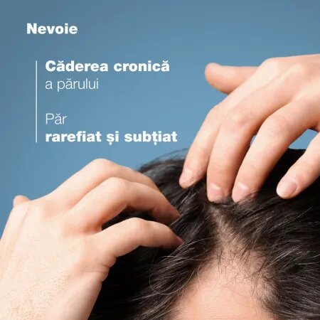 Sampon complementar impotriva caderii parului Anaphase+, 200 ml, Ducray 715313